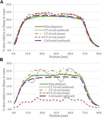 Electron Streaming Effect Associated With the Elekta Unity Anterior Imaging Coil